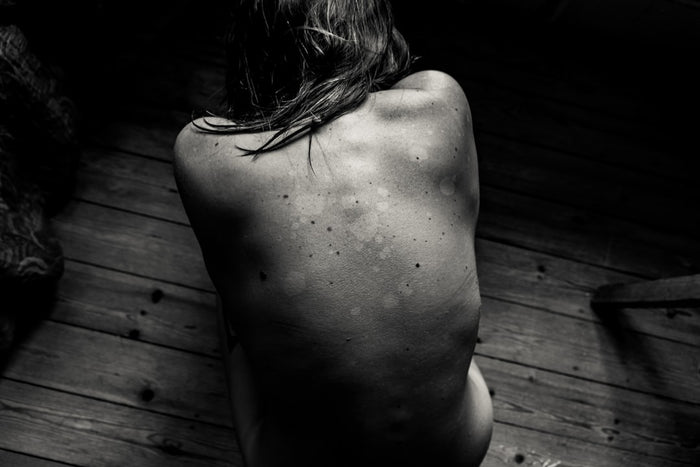 Cupping and Vacuum Play: From Therapy to Torture